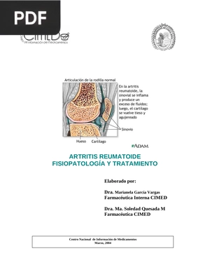 Artritis reumatoide fisiopatología y tratamiento