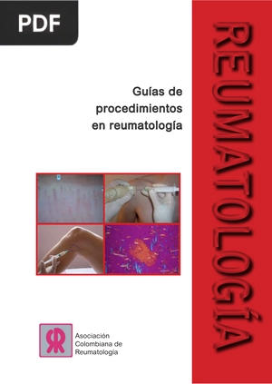 Guías de procedimientos en reumatología