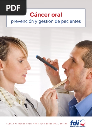 Cáncer oral. Prevención y gestión de pacientes