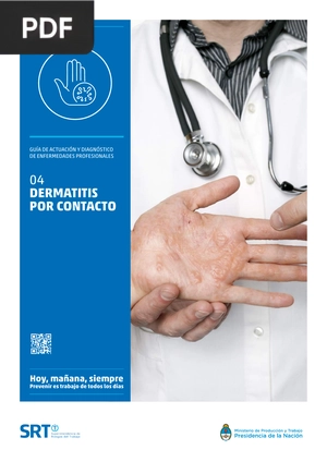 Dermatitis por Contacto