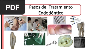 Pasos del Tratamiento Endodóntico (Presentación)