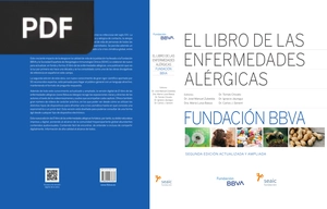 El Libro de las Enfermedades Alérgicas