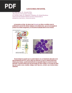 Leucemía infantil (Artículo)