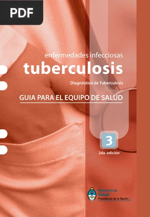 Enfermedades infecciosas: Tuberculosis