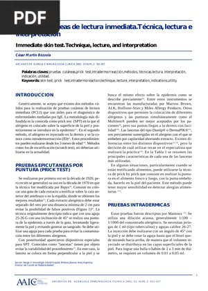 Pruebas cutáneas de lectura inmediata.Técnica, lectura e interpretación (Articulo)