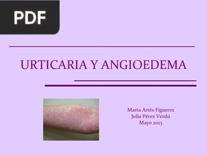 Urticaria y Angioedema (Presentación)