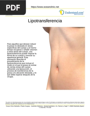 Lipotransferencia (articulo)