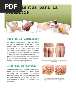 Tratamientos para la Celulitis (Articulo)