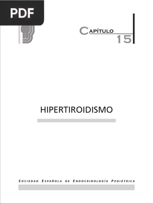 Hipertiroidismo