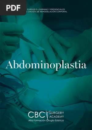 Abdominoplastia