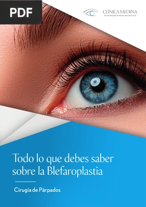 Todo lo que debes saber sobre la Blefaroplastia