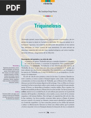 Triquinelosis (Articulo)