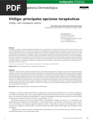 Vitíligo: principales opciones terapéuticas