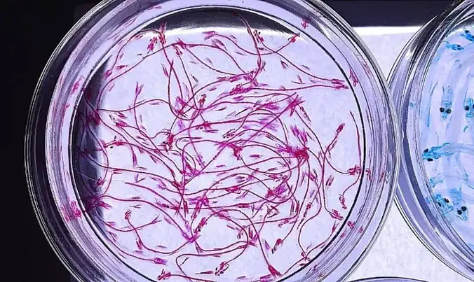 Dónde encontrar libros de microbiología Dónde encontrar libros de microbiología