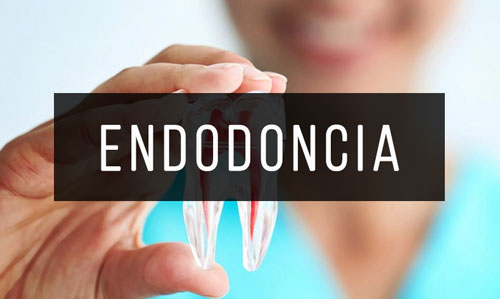 Endodoncia Endodoncia