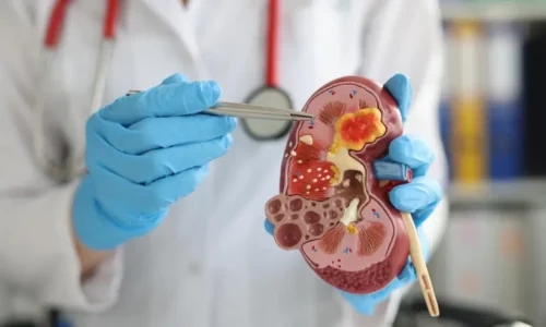 Libros de Urología