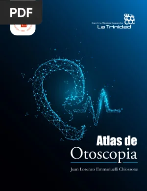 Atlas de otoscopia