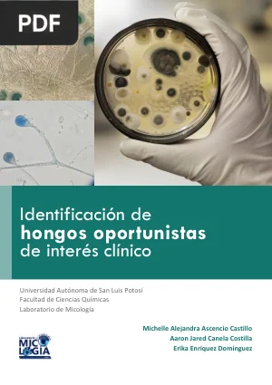 Identificación de hongos oportunistas de interés clínico